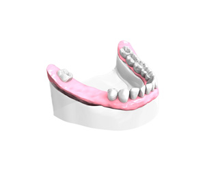 Examen-pre-implantaire-Dentiste - Dentiste Paris